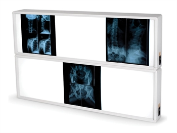 SVETLO BALENIE 76X122 cm - 2x3 panels