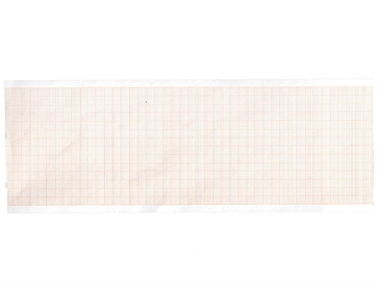 EKG termálny papier 80x20 mm x m rolka