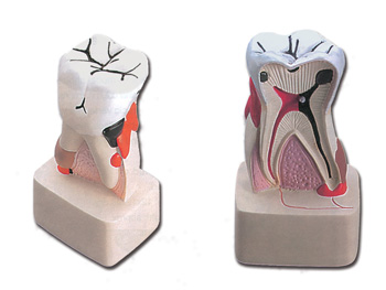DENTÁLNY PATHOLOGY - 4X