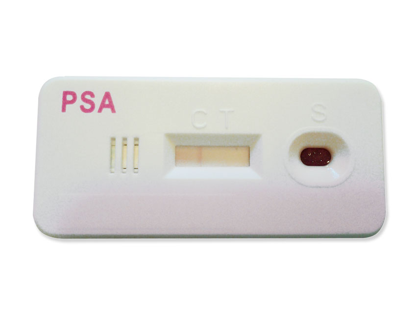 PSA (Prosztata Specifikus Antigén) (Totál PSA)