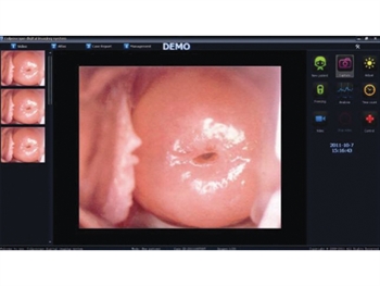 COLPOSCOPY SOFTWARE for 29624, 29625